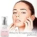 Eye Gel, QQcute Day & Night Anti-Aging Eye Treatment Cream for Wrinkle, Dark Circle, Fine Line, Puffy Eyes, Bags Best Hydrogel Eye Moisturizer for Women - 1.7 fl oz.