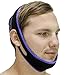 SleepEZzzz - Customizable Anti Snoring Chin Strap - Snoring Aid That Works - Best Solution for Mouth Snorers - Adjustable, Comfortable and Easy to Use