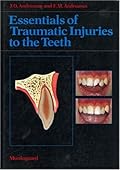 Essentials of Traumatic Injuries to the Teeth-Wow! eBook