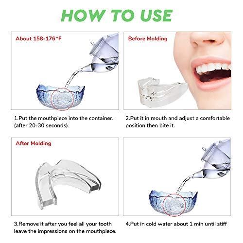 Snore Stopper Mouth Guards for Teeth Grinding, Sleep Aid Custom Fit Night Mouthpiece, Anti Snoring Solution with Case