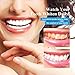 VieBeauti Premium Teeth Whitening Kit with LED Light, HISMILE, At-Home System Without Pain or Sensitivity, Effectively Removes Stains for Whiter Teeth