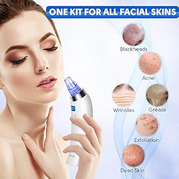 facial blackhead removal near me