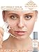 Best Anti Wrinkle Serum – Most Potent On Market, Better Than Gel, Botox Or Cream – Extremely Effective Natural Anti Aging Treatment For All Skin Types –Organic Cruelty Free Vitamin C Serum 20%, Vegan Hyaluronic Acid And Vitamin E, 100% Satisfaction Guarantee, 1 oz