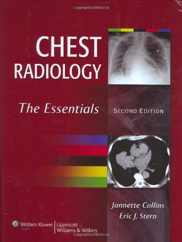Chest Radiology: The Essentials Hardcover – 15 Mar 2007