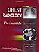 Chest Radiology: The Essentials