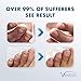 Vanish Fungal Nail Renewal, Nail Fungus Renewal Cream, Effective on Toenail and Fingernail Treatment | 3x more cream, 30ml | Helpful E-Book Included