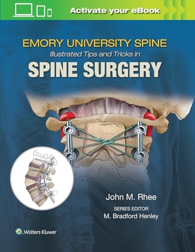 Spine Surgery: Tricks of the Trade: 9781604068962: Medicine