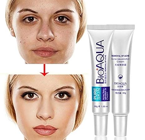 bioaqua acne review