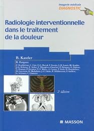 Radiologie interventionnelle dans le traitement de la douleur