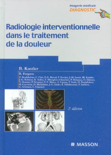 Radiologie interventionnelle dans le traitement de la douleur