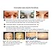 Koi Beauty Titanium Stamp 2.0mm / 42 Tips Best  Beauty Tool  for Acne Scar Freckle