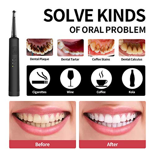 Electric Dental Calculus Remover with LED, HighFrequency Vibration