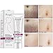 Enjoyment Scars Removal Cream Stretch Marks Cream Pregnancy Skin Care Belly Butter - Plant Nutrition Repair Ingredients to Help Prevent & Reduce Stretch Marks, 40G/1.4oz