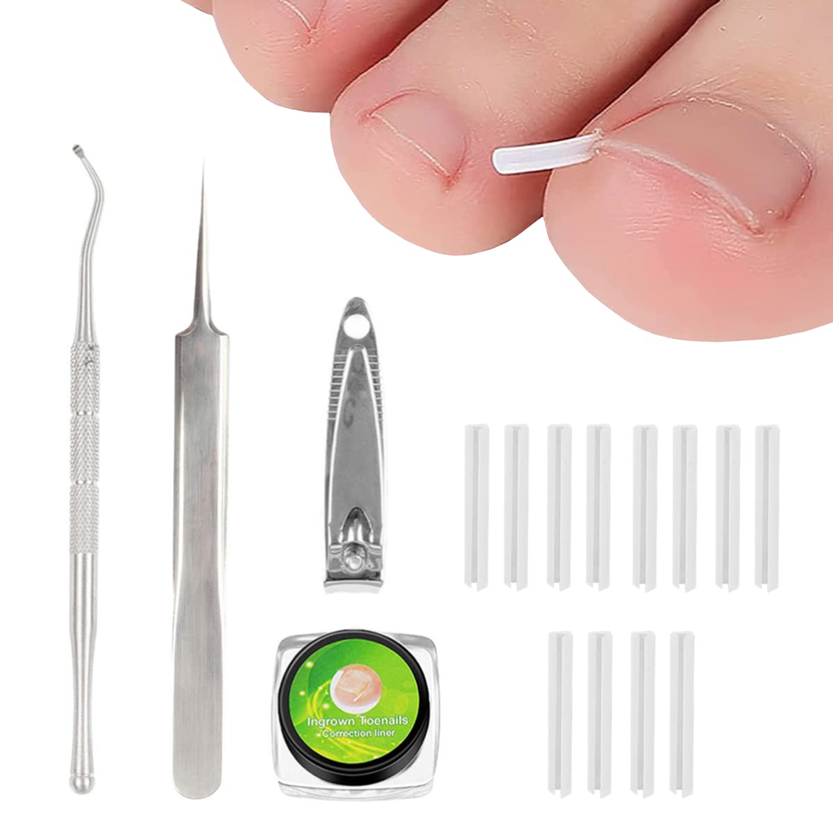 Ingrown Toenail Correction Treatment Kit with 12 Pcs Ingrown Toenail Correction Pad Recover Clips Ingrown Toenail Corrector Straightener Strips for Women Men's Nail Treatment Pedicure Tool (4 Pcs Set)