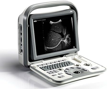 SonoScape A6 Portable Digital OB / Gyn or MSK / Podiatry System NEW