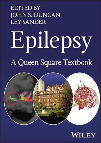 Epilepsy: A Comprehensive Textbook: 9781975105525: Medicine