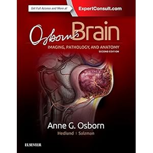 Osborn's Brain, 2e