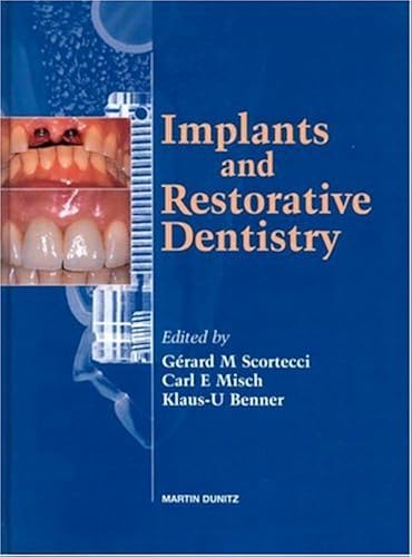 Download Implants and Restorative Dentistry PDF