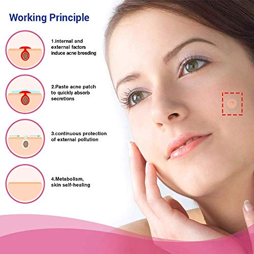 OHeal Acne Pimple Master Patch 108 dots - Absorbing Hydrocolloid Blemish Spot Skin Treatment (108 Patches, 3Pack)