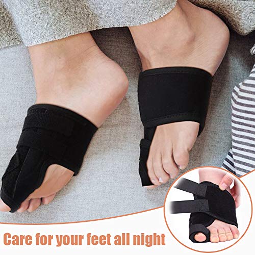 Bunion Corrector - Orthopedic Bunion Corrector - Toe Separators - Toe Spacers - Bunion Splint - Toe Straightener - Toe Support - Hallux Valgus - Toe Splint - Correct Toes - Thumbnail 3