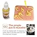 PMAG Perfect for Simulated Zits Acne Squeeze Pimple Popping Stress Relief Toy for Adults Kids Teens Anxiety