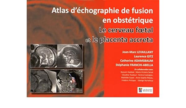 Le Cerveau Foetal Et Le Placenta Accreta Atlas D - 