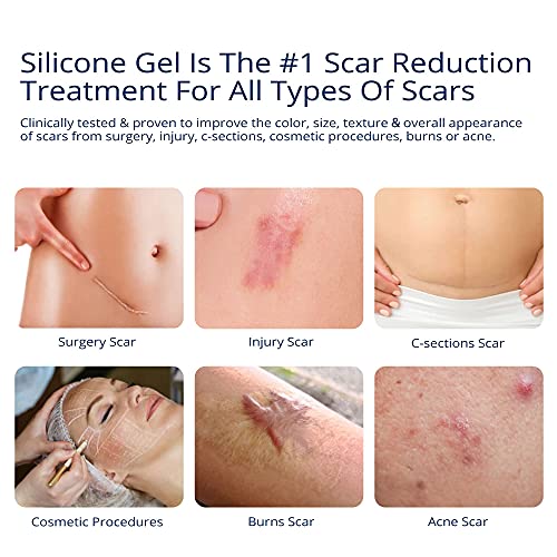 100 Silicone Scar Gel Scar Cream Advanced Scar Gel for Surgical