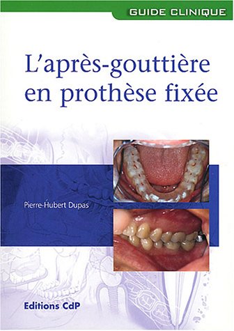 L' après-gouttière en prothèse fixée
