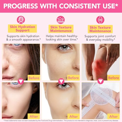 Multi Collagen Peptides Powder, 1 lb Unflavored Hydrolyzed Collagen Types I, II, III, V, X，16 oz (41 Servings)-Hyaluronic Acid Power,Grass Fed Collagen Supplements for Women and Men, Non GMO