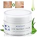Acne Treatment, Acne Removal Cream, Pimple Treatment, Face Skin Repair Cream, Acne Spots Treatment Cream, Get Rid of acne & Pimples (1oz)
