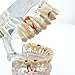 Easyinsmile Dental Pathology Model Half Implant Tooth Model for Dentist Studying Researching and Patient Education
