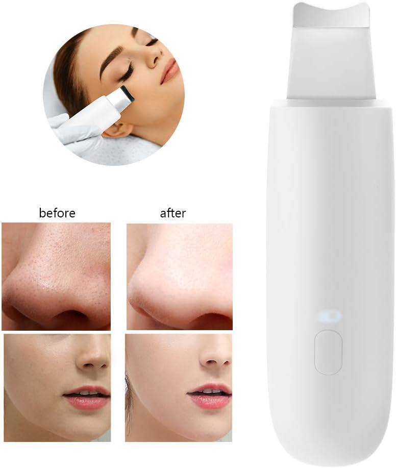 Dispositivo facial - Máquina de limpieza Exfoliante Limpiador ...