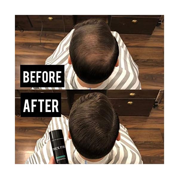 THICK FIBER Hair Fibres (Pack of 1 DARK BROWN) | Hair Powder for Thinning Hair 25g Bottle | Makes Thin Hair Look Thicker…