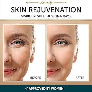 lorandy retinol cream