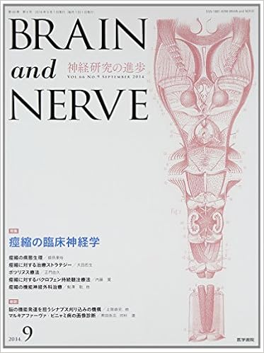 Brain And Nerve 神経研究の進歩 2014年 9月号 特集 痙縮の臨床神経学 本 通販 Amazon