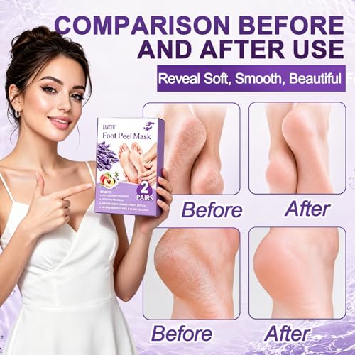 2 Pairs Foot Exfoliating Socks, Foot Peeling Mask, Exfoliating Socks, Moisturizing for Dry Cracked Feet, Exfoliating Socks for Women and Men (Lavender)