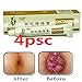 Hemorrhoids Cream-Chinese Herbal for Treatment Hemorrhoids Cream Anus Prolapse Anal Fissure Antibacterial Cream (4)
