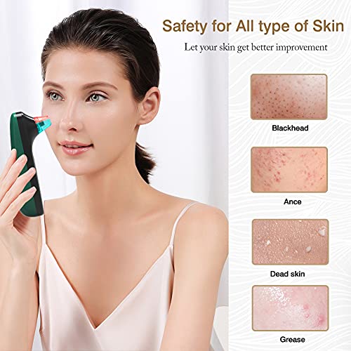 Blackhead Remover Vacuum Pimple Blackhead Extractor Electric Facial