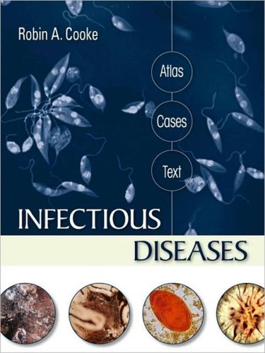 INFECTIOUS DISEASES