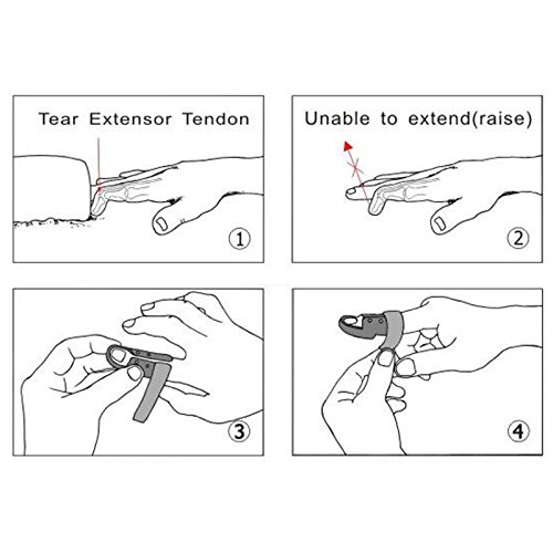 ZeHui Plastic Finger Injury Support Brace Pain Splint Joint Mallet Protection Plastic Phalanx Clip 0 - Thumbnail 7