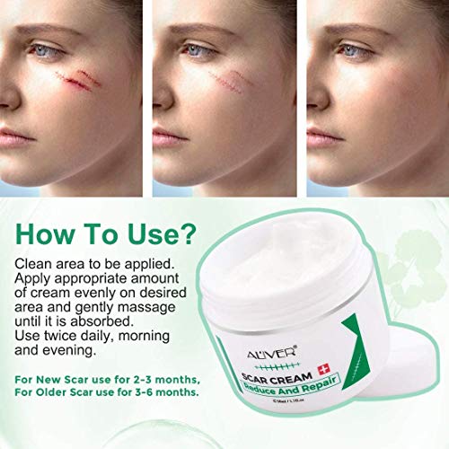 Scar Cream for Old & New Scars, Scar Removal Cream Effective Stretch
