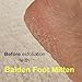 Baiden Foot Mitt, Super Effective Hard, Rough, Cracked Skin, Callus Remover For Soft, Beautiful Feet Every Day. More Flexible Than Microplane, More Durable Than Pumice Stone Fast, Easy Tool (1pack)