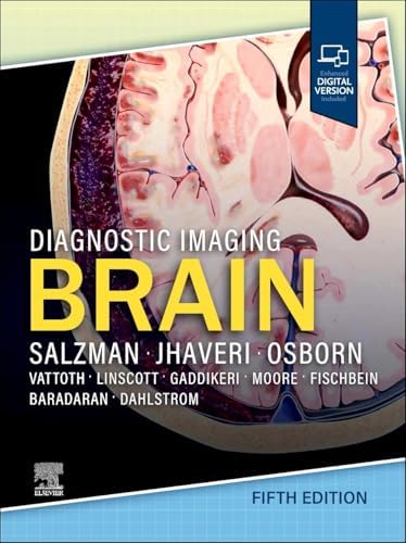 Diagnostic Imaging: Brain: 9781931884723: Medicine & Health