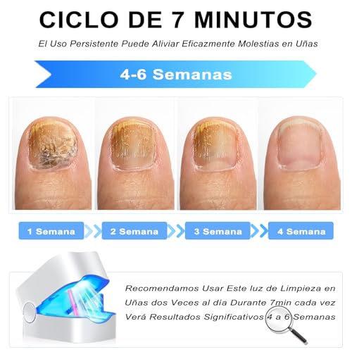 TRYXZSZ Dispositivo Portátil de Limpieza en las Uñas, Pequeño y lindo, fácil de usar, Combinación luz Dual 905 nm y 470 nm, Ciclo de Uso de 7 Minutos, Ayuda a Aliviar las Molestias en las Uñas