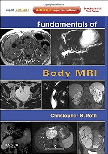 Download Fundamentals Of Body Ct Webb
