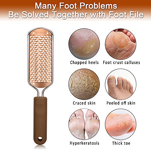 Foot File Callus Remover - INFILILA Pedicure Foot File Feet Callus Remover Large Foot Rasp Foot Scrubber Professional Stainless Steel Callus File for Wet and Dry Feet