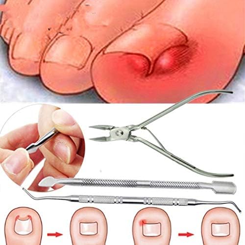 callm 3Pcs/Set Ingrown Toe Nail Correction Nippers Clipper Cutters Dead Skin Dirt