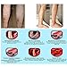 STCorps7 Chinese Medicine Herbal Ointment Varicose Veins Vasculitis Treatment Care Cream