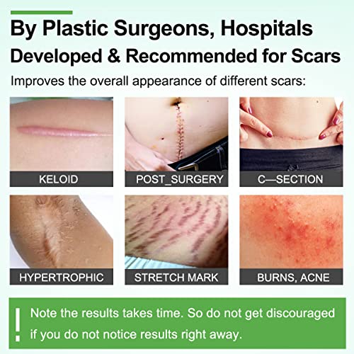 ZODENIS Scar Away Silicone Scar Sheets, Scar Tape(1.8” x 157”Inch- 4M), Scar Strips, Reusable, Professional Scar Remover for C-Section, Surgery, Keloid, Tummy Tuck, Scar Patch, Scar Pads.