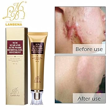 black skin scar removal cream